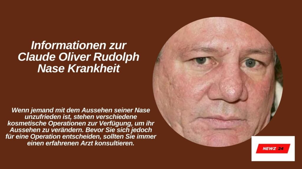 Claude Oliver Rudolph Nasenkrankheit